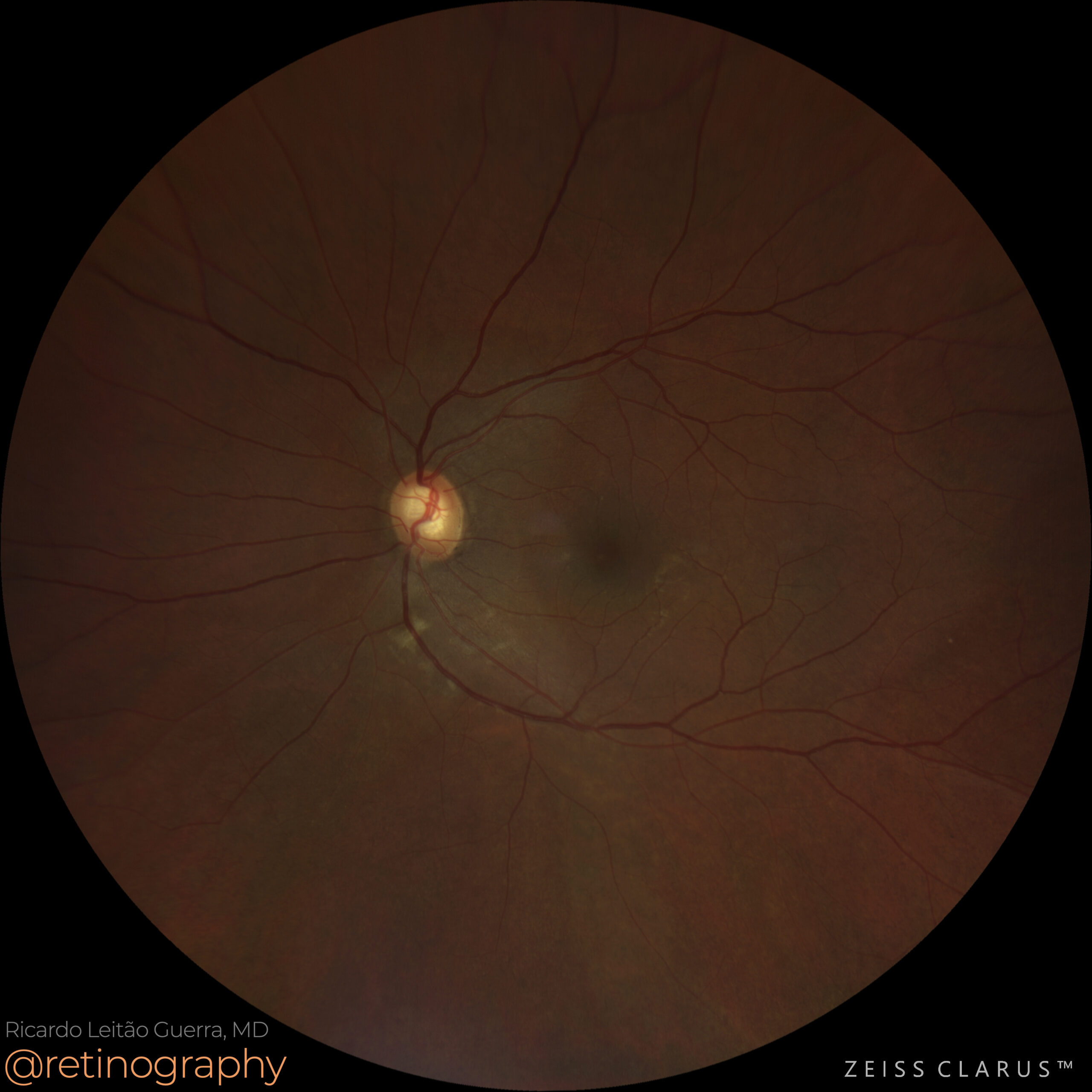 Imagem 0